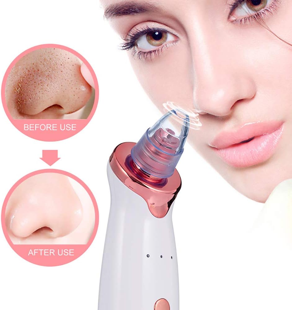 Aspirateur de points noirs happilyskin – Image 4