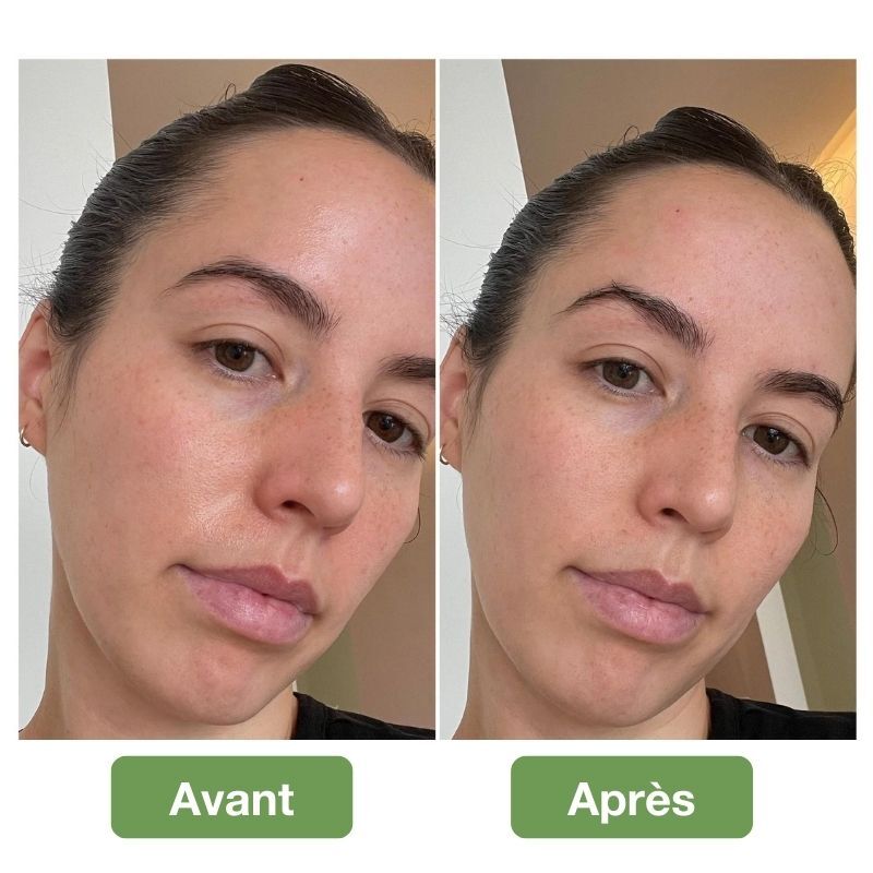 Rouleau volcanique pour une peau mate – Image 4