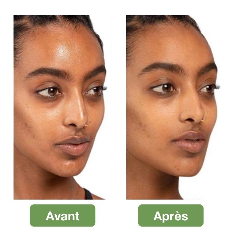 Rouleau volcanique pour une peau mate – Image 5