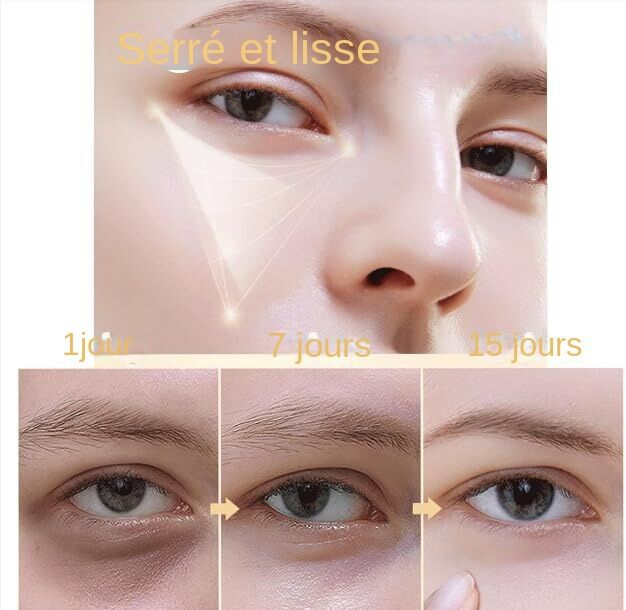 Rovea Celyn Crème Anti Cernes et Rides Instantanée – Image 9