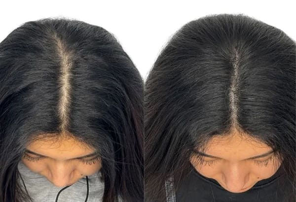 LuxGrow Brosse à cheveux phototherapique repousse des cheveux – Image 8