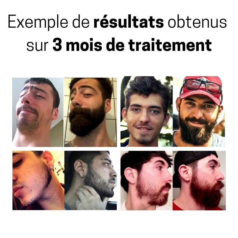 Rouleau repousse cheveux & barbe - instaroller – Image 6