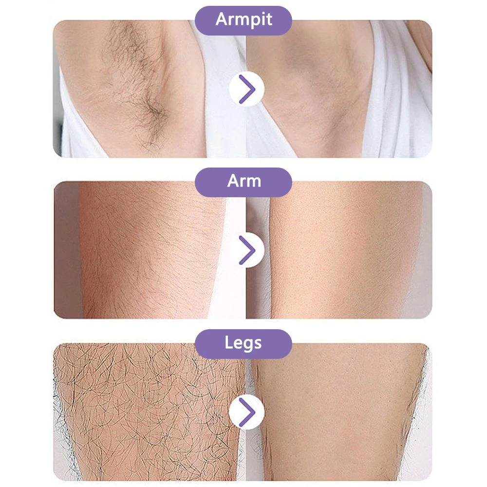 Gomme à Cheveux en Cristal Pour Épiler les Bras, le Torse et les Jambes - GBOKYN – Image 3