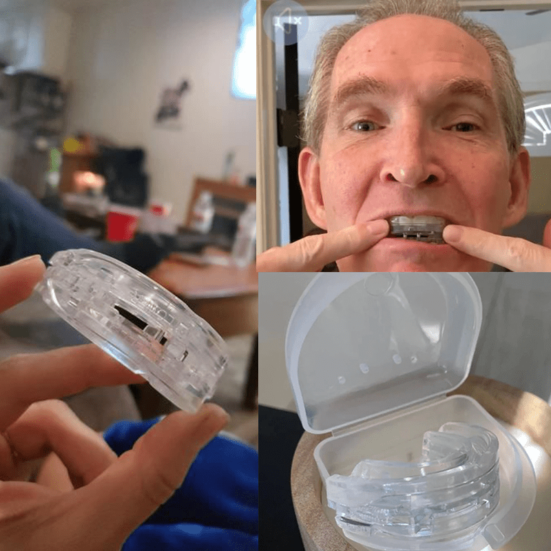 Appareil de protection buccale anti-ronflement PaxySleep