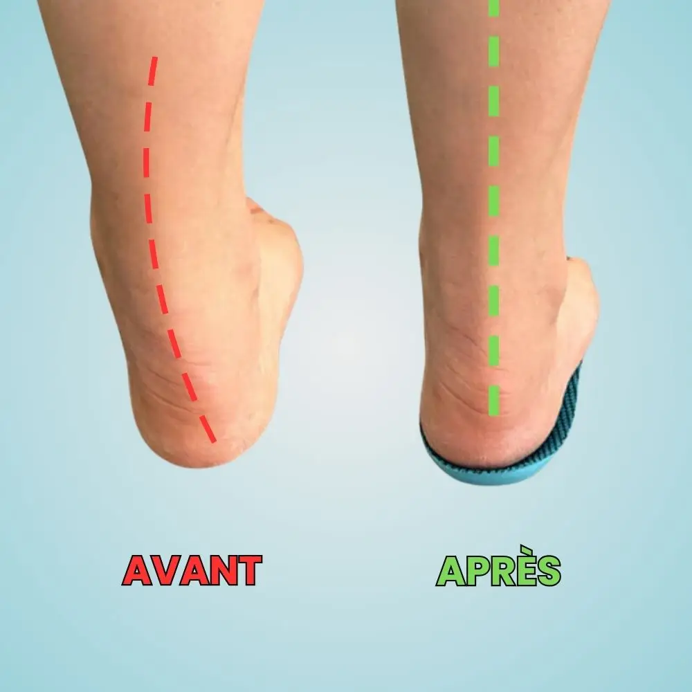 OrthoFlex semelles orthopédiques hallux valgus – Image 8