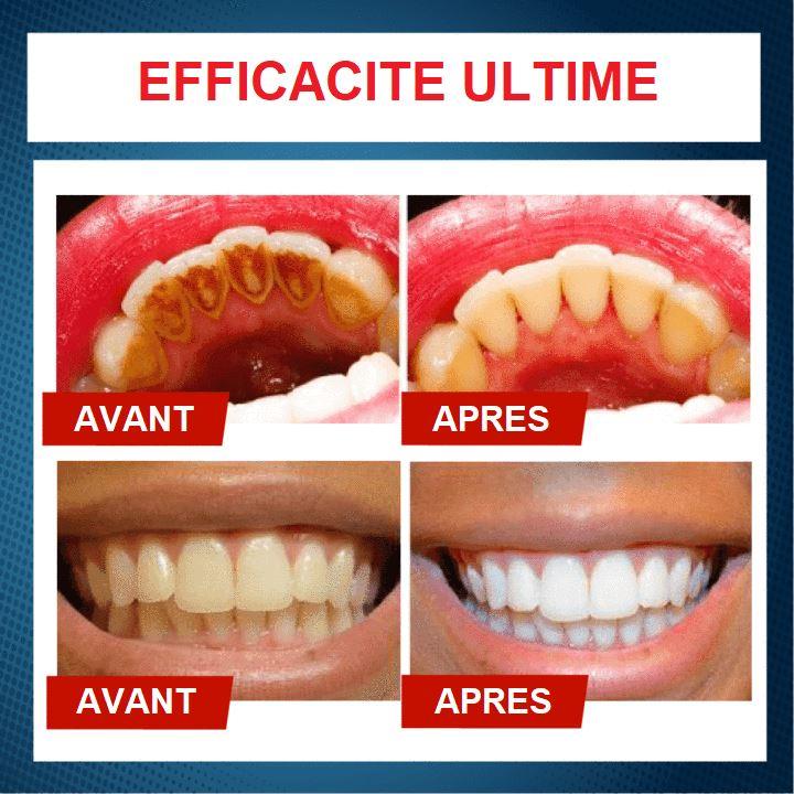 Dentifrice pour le blanchiment des dents - maxisourire – Image 8
