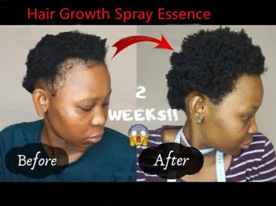 usage de Shampoing solide anti cheveux