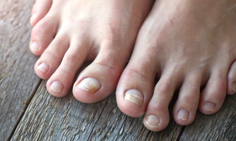 Sherum Coupe-Ongles Ergonomique à Large Tête Angulaire avec Attrape-Ongles