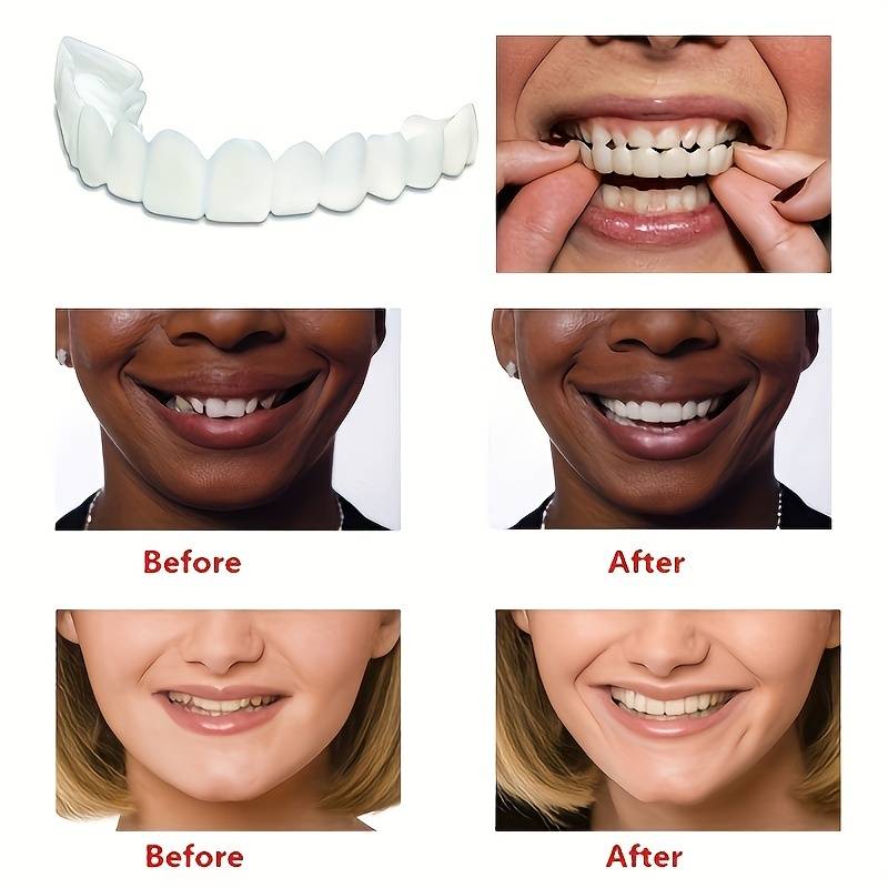 Couvre dents pour un sourire parfait