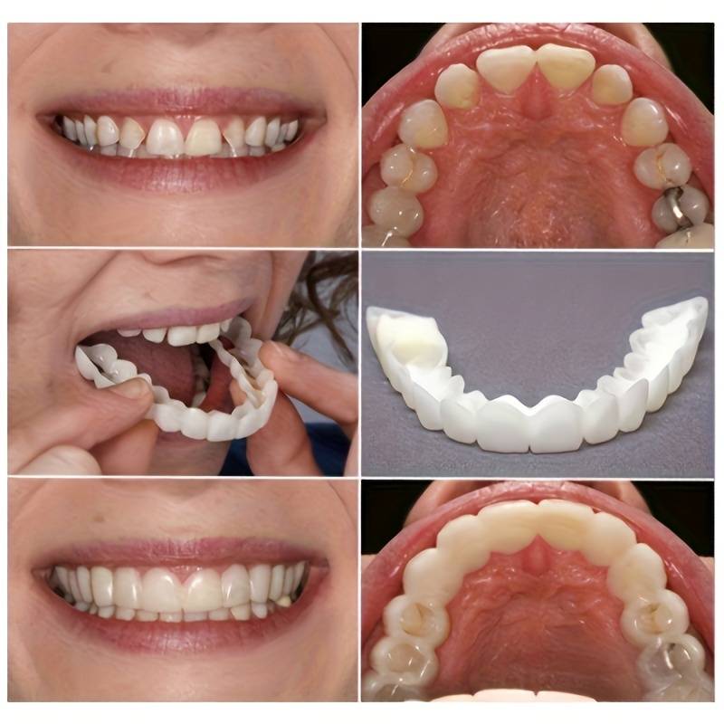 Couvre dents adapté à tous