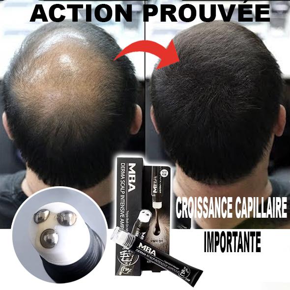 Avant et après utilisation du sérum après quelques semaines