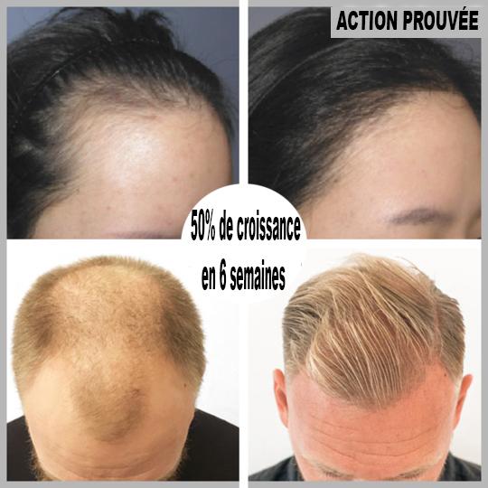 Avant et après utilisation du sérum après 6 semaines