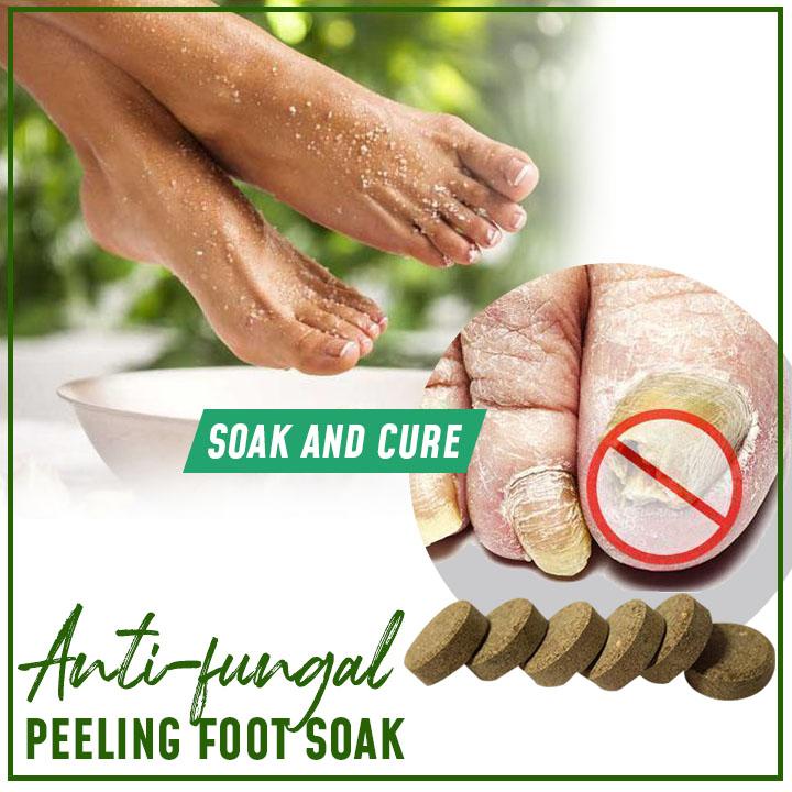 Traitement anti-fongique pour les ongles – Image 2