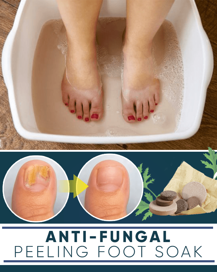 Traitement anti-fongique pour les ongles – Image 3