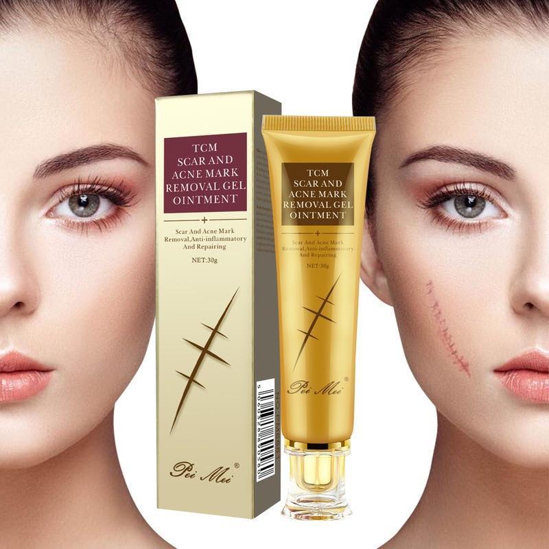 Crème anti-cicatrices jeunesse