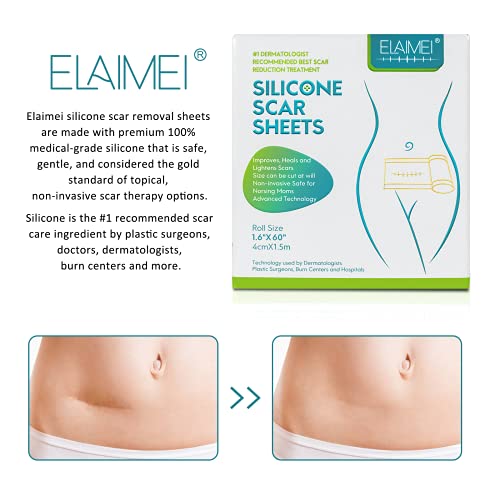 Ruban médical en gel de silicone souple pour l'élimination des cicatrices. – Image 5