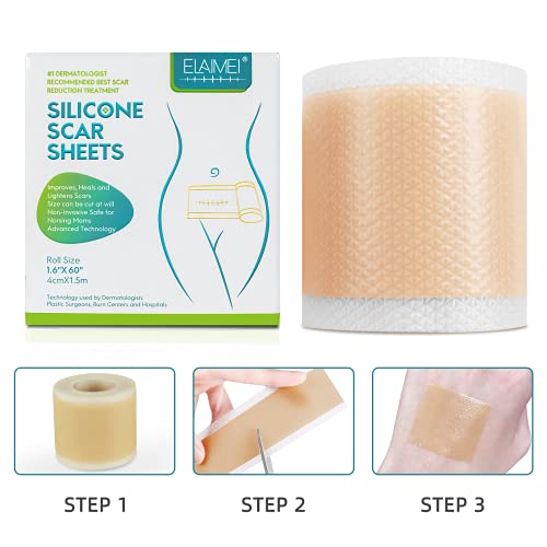 Ruban médical en gel de silicone souple pour l'élimination des cicatrices. – Image 6