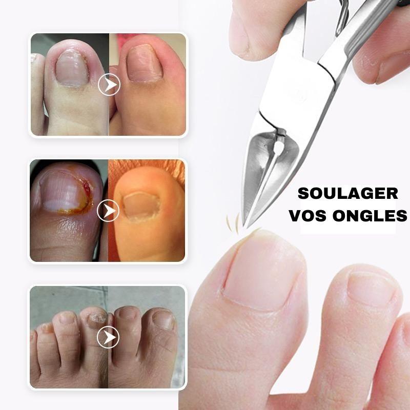 Coupe ongles – Image 2