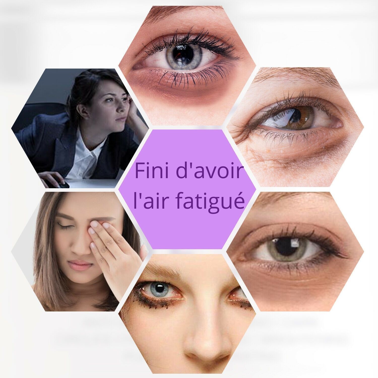 Crème sous les yeux élimine les cernes et les poches – Image 5