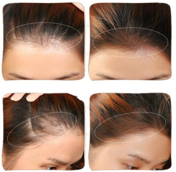 Poudre spéciale racine densifiante pour cheveux avec effet ombré – Image 3