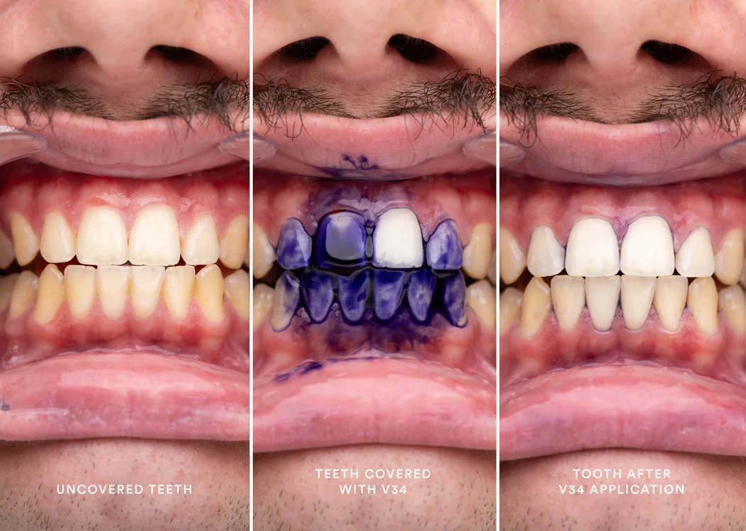 Hismile dentifrice violet blanchissant – Image 4