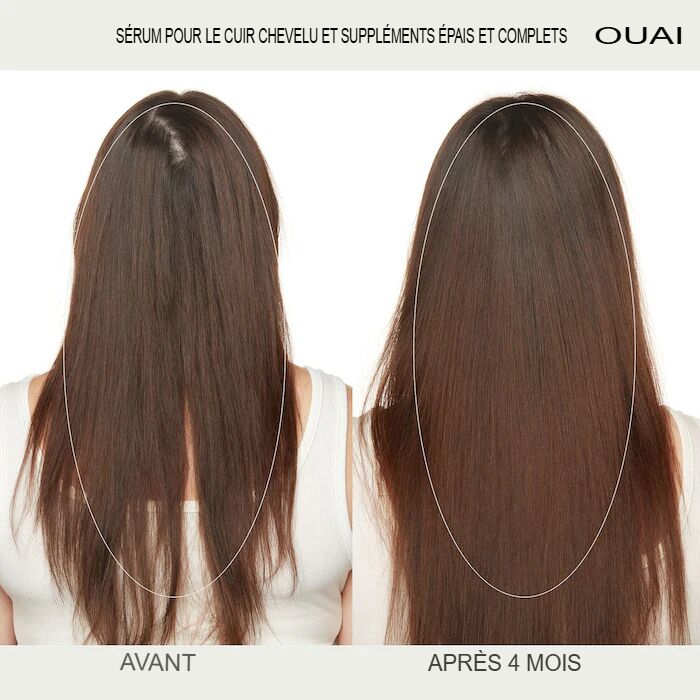 Ginseng et peptides de Sibérie – Image 7