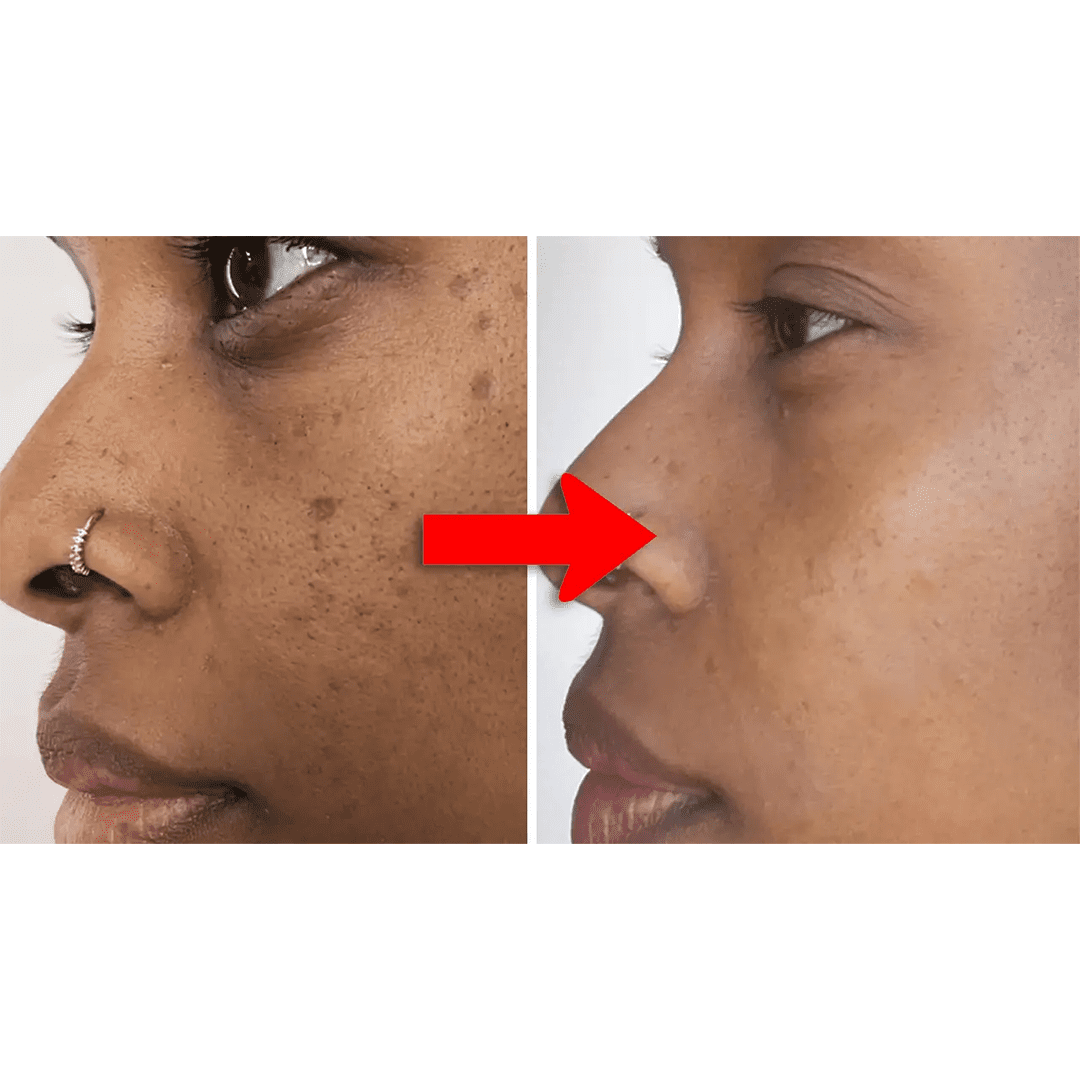Lunavia savon anti-taches brune à l'acide kojique – Image 8