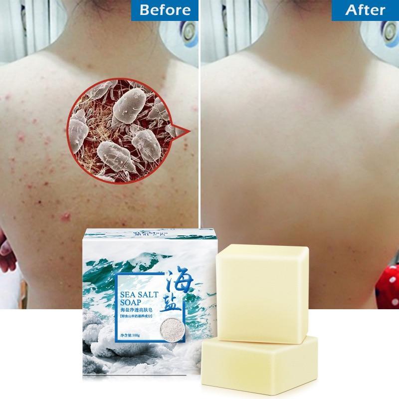 Savon naturel anti-acné au sel de mer - madiga – Image 2
